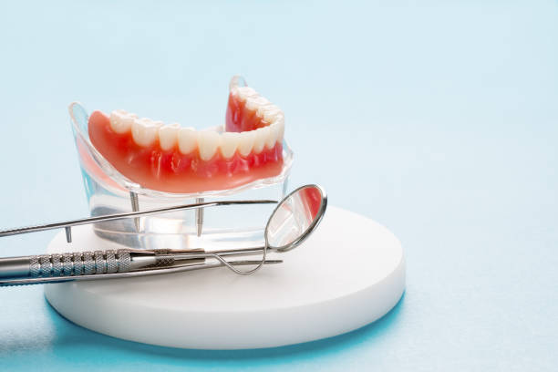 Full Mouth Reconstruction in Elton, LA