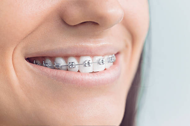 Best Periodontal (Gum) Disease Treatment  in Elton, LA